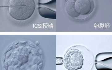 孩子也能生上癮！德國60多歲婦女“人工授精”誕下4包胎