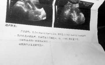 ART-ECO生殖健康診所：25年運營有9135名兒童出生
