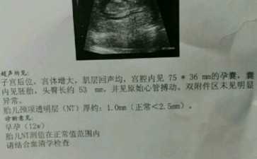 gv卵培养成熟后能不能配成功？ivm试管卵要培养几天？~~助孕零风险